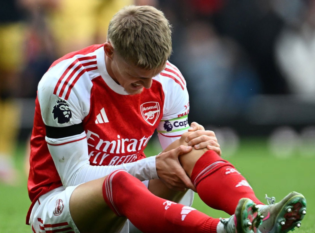 Sports Betting Kapten Arsenal Martin Ødegaard Alami Cedera Ligamen